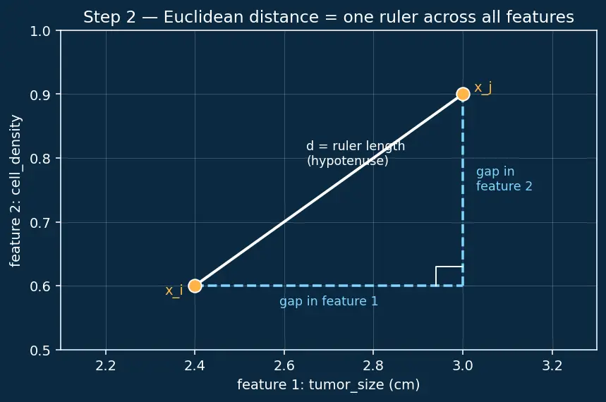 Figure — Handling imbalanced datasets (SMOTE, undersampling)